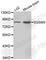 Small G Protein Signaling Modulator 3 antibody, A3420, ABclonal Technology, Western Blot image 