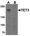 Tet Methylcytosine Dioxygenase 3 antibody, GTX02579, GeneTex, Western Blot image 