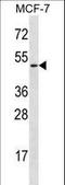 LADA antibody, LS-C165665, Lifespan Biosciences, Western Blot image 