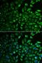Inositol Monophosphatase 1 antibody, LS-C334674, Lifespan Biosciences, Immunofluorescence image 
