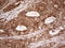 Metadherin antibody, LS-C339007, Lifespan Biosciences, Immunohistochemistry paraffin image 