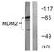 Hdm2 antibody, TA311996, Origene, Western Blot image 