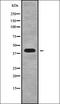 TNFAIP3 Interacting Protein 3 antibody, orb337879, Biorbyt, Western Blot image 
