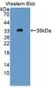 Cellular Communication Network Factor 2 antibody, MBS2025792, MyBioSource, Western Blot image 