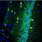 SH3 And Multiple Ankyrin Repeat Domains 1 antibody, PA5-77700, Invitrogen Antibodies, Immunohistochemistry frozen image 