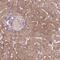 ADPRT3 antibody, HPA067657, Atlas Antibodies, Immunohistochemistry frozen image 