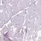 Myristoylated Alanine Rich Protein Kinase C Substrate antibody, NBP2-62663, Novus Biologicals, Immunohistochemistry paraffin image 