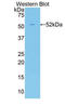 Apelin antibody, LS-C422920, Lifespan Biosciences, Western Blot image 