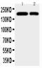 CD11b antibody, PA1943-1, Boster Biological Technology, Western Blot image 