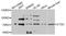 Cathepsin C antibody, A8403, ABclonal Technology, Western Blot image 