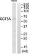 Chaperonin Containing TCP1 Subunit 6A antibody, TA313572, Origene, Western Blot image 