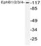 EPH Receptor B1 antibody, AP21112PU-N, Origene, Western Blot image 