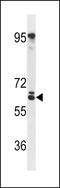 Ring Finger And SPRY Domain Containing 1 antibody, LS-C156020, Lifespan Biosciences, Western Blot image 