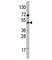 Vascular Endothelial Growth Factor D antibody, F49567-0.4ML, NSJ Bioreagents, Western Blot image 