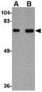 Translocase Of Outer Mitochondrial Membrane 70 antibody, GTX85353, GeneTex, Western Blot image 
