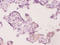 Ubiquitin Conjugating Enzyme E2 K antibody, LS-C285693, Lifespan Biosciences, Immunohistochemistry paraffin image 