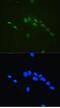 Core-Binding Factor Subunit Beta antibody, A01007-1, Boster Biological Technology, Immunofluorescence image 