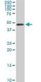 TSC22 Domain Family Member 4 antibody, H00081628-M07, Novus Biologicals, Western Blot image 