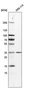 Potassium Channel Tetramerization Domain Containing 10 antibody, PA5-53138, Invitrogen Antibodies, Western Blot image 