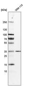 Potassium Channel Tetramerization Domain Containing 10 antibody, PA5-53138, Invitrogen Antibodies, Western Blot image 