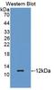 Regenerating Family Member 3 Gamma antibody, LS-C727170, Lifespan Biosciences, Western Blot image 