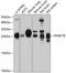 RAB27B, Member RAS Oncogene Family antibody, GTX64615, GeneTex, Western Blot image 