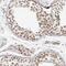 Nucleoporin 153 antibody, NBP1-81724, Novus Biologicals, Immunohistochemistry paraffin image 