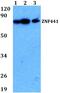 Zinc Finger Protein 441 antibody, PA5-75786, Invitrogen Antibodies, Western Blot image 