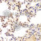 Casein Kinase 2 Alpha 1 antibody, A1616, ABclonal Technology, Immunohistochemistry paraffin image 