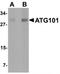 Autophagy Related 101 antibody, TA319995, Origene, Western Blot image 