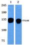 Integrin Subunit Alpha E antibody, A07091, Boster Biological Technology, Western Blot image 