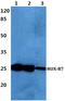 Homeobox B7 antibody, A03908, Boster Biological Technology, Western Blot image 