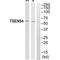 TRNA Splicing Endonuclease Subunit 54 antibody, PA5-50148, Invitrogen Antibodies, Western Blot image 