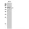 SH2B Adaptor Protein 2 antibody, LS-C382075, Lifespan Biosciences, Western Blot image 