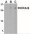 ORAI Calcium Release-Activated Calcium Modulator 2 antibody, NBP1-77283, Novus Biologicals, Western Blot image 