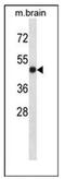 Lymphotoxin Beta Receptor antibody, AP52559PU-N, Origene, Western Blot image 