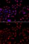 Solute Carrier Family 22 Member 11 antibody, GTX33503, GeneTex, Immunocytochemistry image 