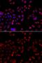 Solute carrier family 22 member 11 antibody, GTX33503, GeneTex, Immunocytochemistry image 