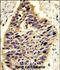 Proliferation-Associated 2G4 antibody, A02791-1, Boster Biological Technology, Immunohistochemistry paraffin image 