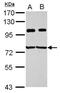 Insulin Like Growth Factor 2 MRNA Binding Protein 3 antibody, NBP2-16930, Novus Biologicals, Western Blot image 