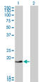 DCMP Deaminase antibody, LS-C104934, Lifespan Biosciences, Western Blot image 