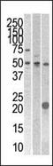 Serine/Threonine/Tyrosine Kinase 1 antibody, PA5-14804, Invitrogen Antibodies, Western Blot image 