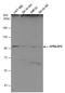 G Protein-Coupled Receptor Associated Sorting Protein 2 antibody, GTX120670, GeneTex, Western Blot image 