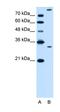 Granzyme K antibody, orb330403, Biorbyt, Western Blot image 