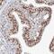Protein Phosphatase 4 Regulatory Subunit 2 antibody, PA5-57018, Invitrogen Antibodies, Immunohistochemistry paraffin image 