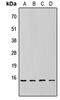 Eukaryotic Translation Initiation Factor 4E Binding Protein 1 antibody, LS-C358477, Lifespan Biosciences, Western Blot image 