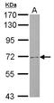 Solute Carrier Family 4 Member 8 antibody, LS-C155211, Lifespan Biosciences, Western Blot image 