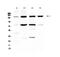 Integrin Subunit Alpha 5 antibody, A01911, Boster Biological Technology, Western Blot image 
