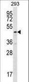 Tubulin Folding Cofactor E Like antibody, LS-C161743, Lifespan Biosciences, Western Blot image 