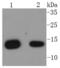 Beta-2-Microglobulin antibody, A00456-5, Boster Biological Technology, Western Blot image 